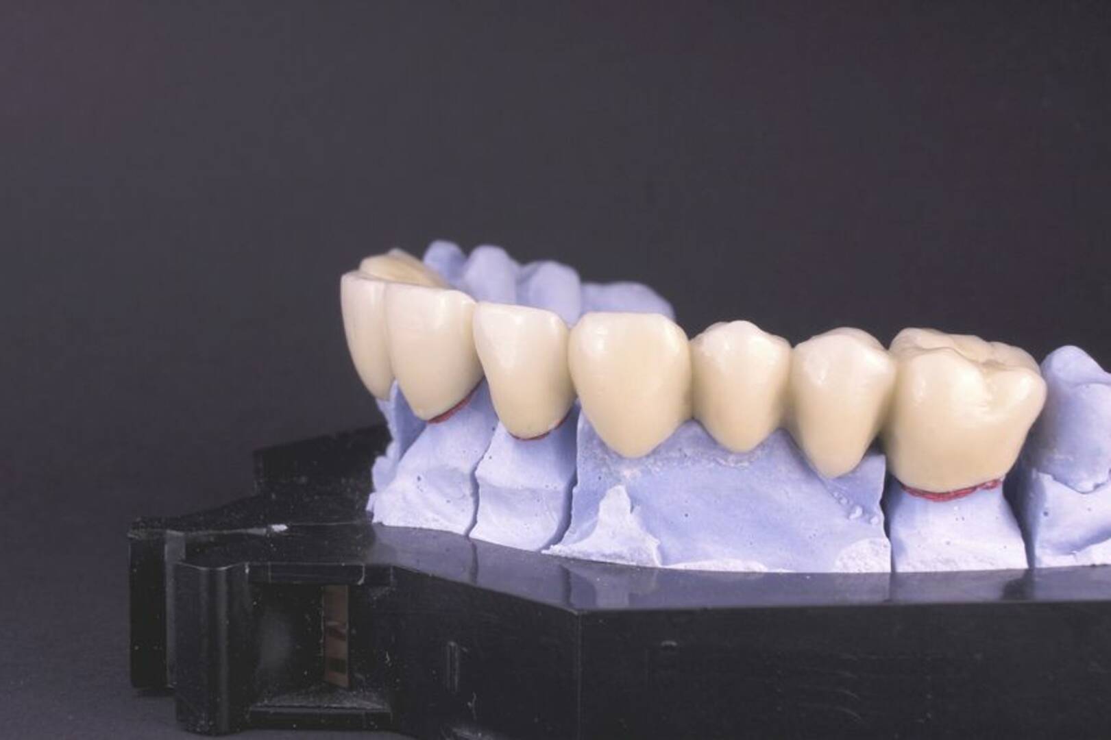 Family Dental Services Osceola IN